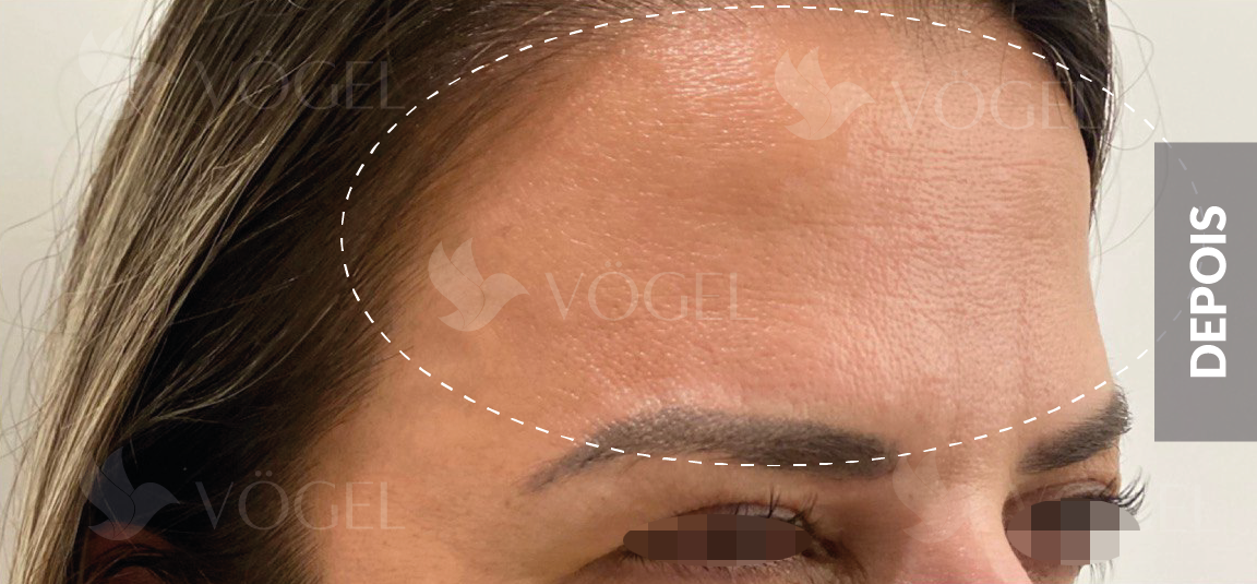 AntesDepois (40)